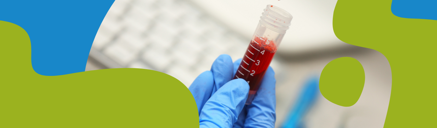 Homocysteine: What It Is, Normal Levels & Testing